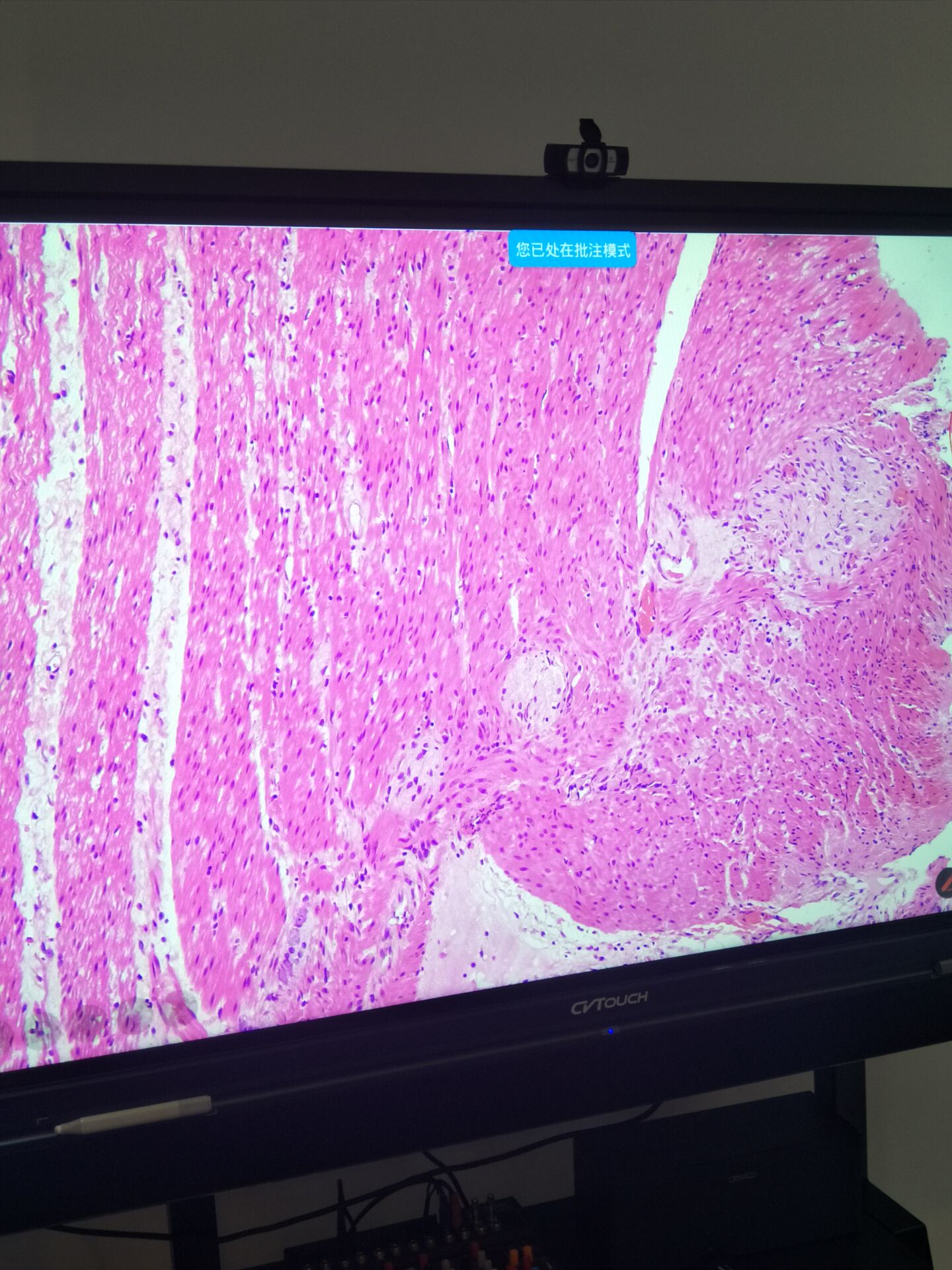  @΢Rz^(yng)t(y)Ժh(yun)ҕlϵy(tng)(D)